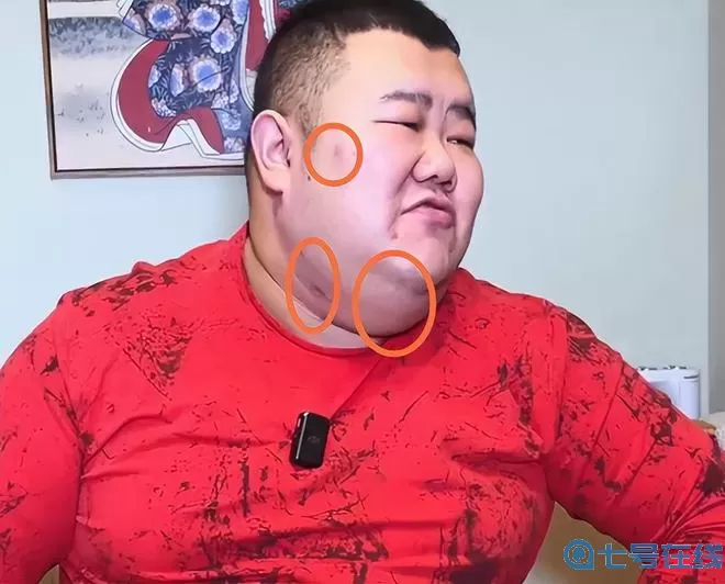 泡泡龙脸上黑斑是什么病?黑斑图片和症状图片