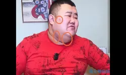 泡泡龙脸上黑斑是什么病？黑斑图片和症状图片