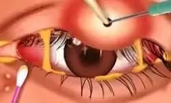 住客大人的心愿拉夫在哪