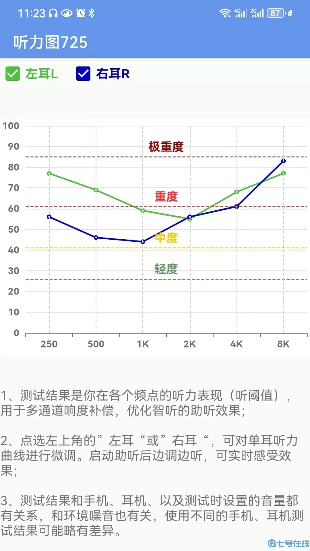 智听官方免费下载