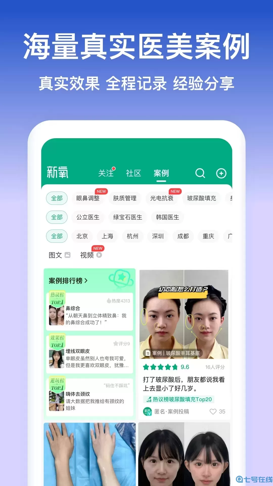 新氧极速版官网正版下载